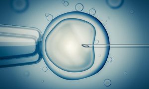 IVF Behandlung